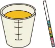 尿検査 尿検査